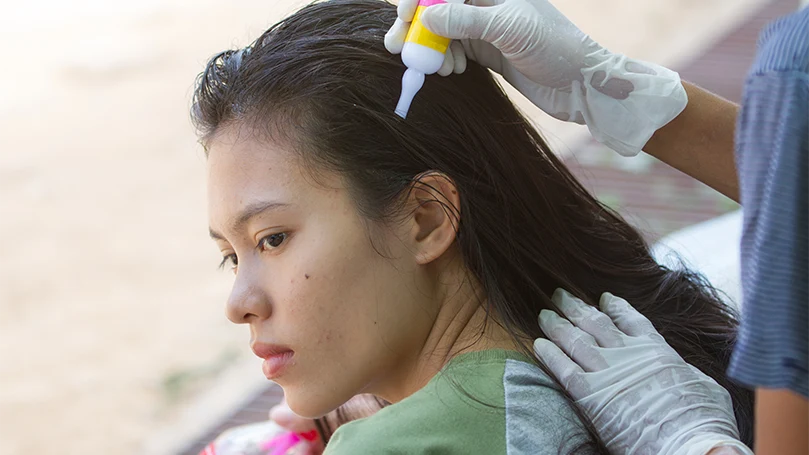 An image of a woman using head lice treatment for her hair.