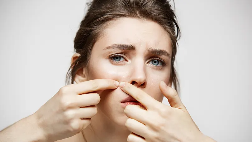 An image of a young brunette having problems with skin.