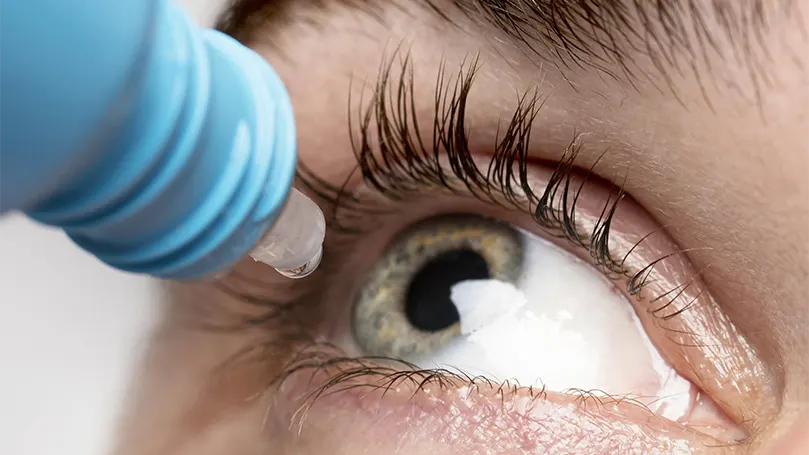An image of a person dropping eye drops into their eye