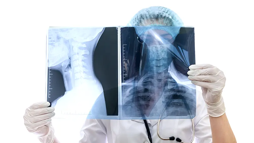 An image of a doctor examining a patient's xray and compression fracture.