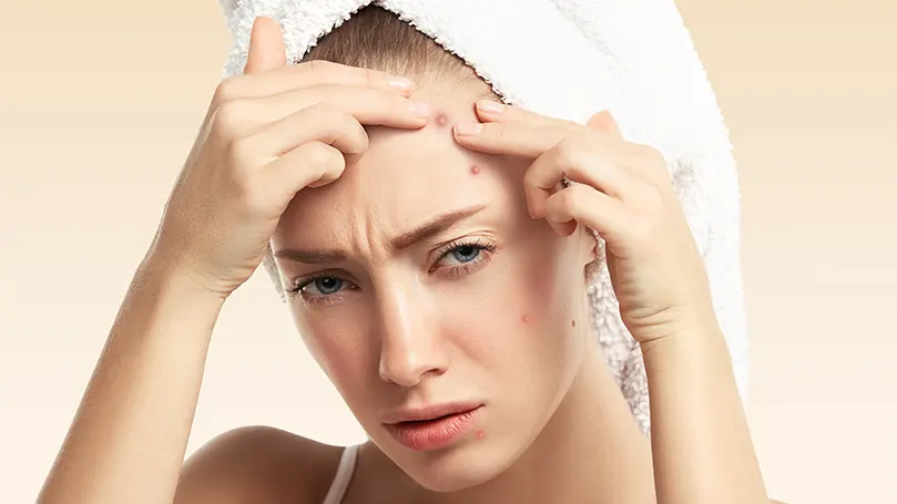 An image of a woman pressing acnes on her face.